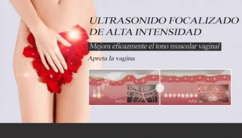 HIFU Vaginal Tightening: A Safe, Effective Alternative to Traditional Rejuvenation Methods