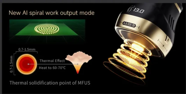 Процедура HIFU с объяснениями: Наука, лежащая в основе превосходного подтягивания кожи