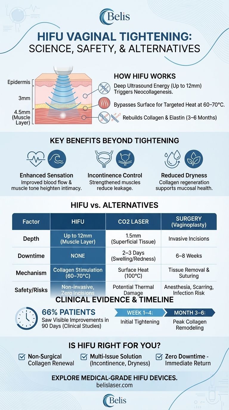 HIFU Vaginal Tightening: Science, Safety, and How It Stacks Up Against Alternatives Visual Guide