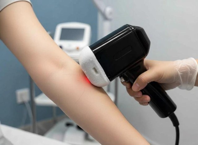 トリレーザー脱毛の仕組み：科学的根拠に基づく安全性と有効性ガイド