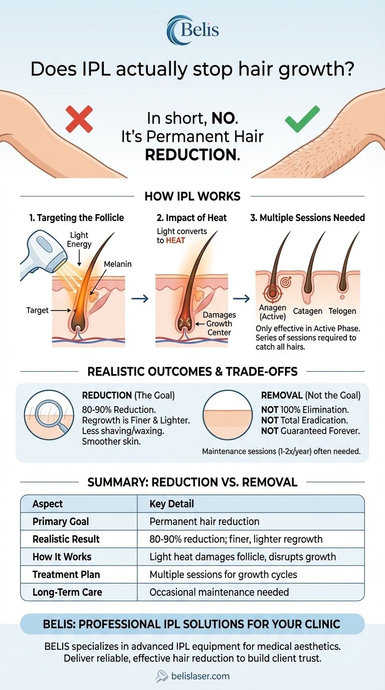 Does IPL actually stop hair growth? Understanding Long-Term Hair Reduction Visual Guide