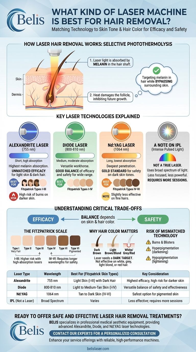 What kind of laser machine is best for hair removal? Match Technology to Skin Tone for Maximum Results Visual Guide