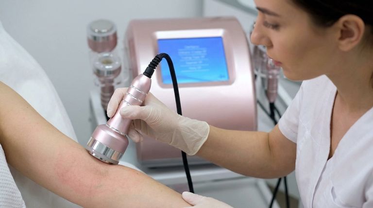 ¿Cuál es la desventaja de la RF? Comprender los riesgos para un estiramiento de piel seguro