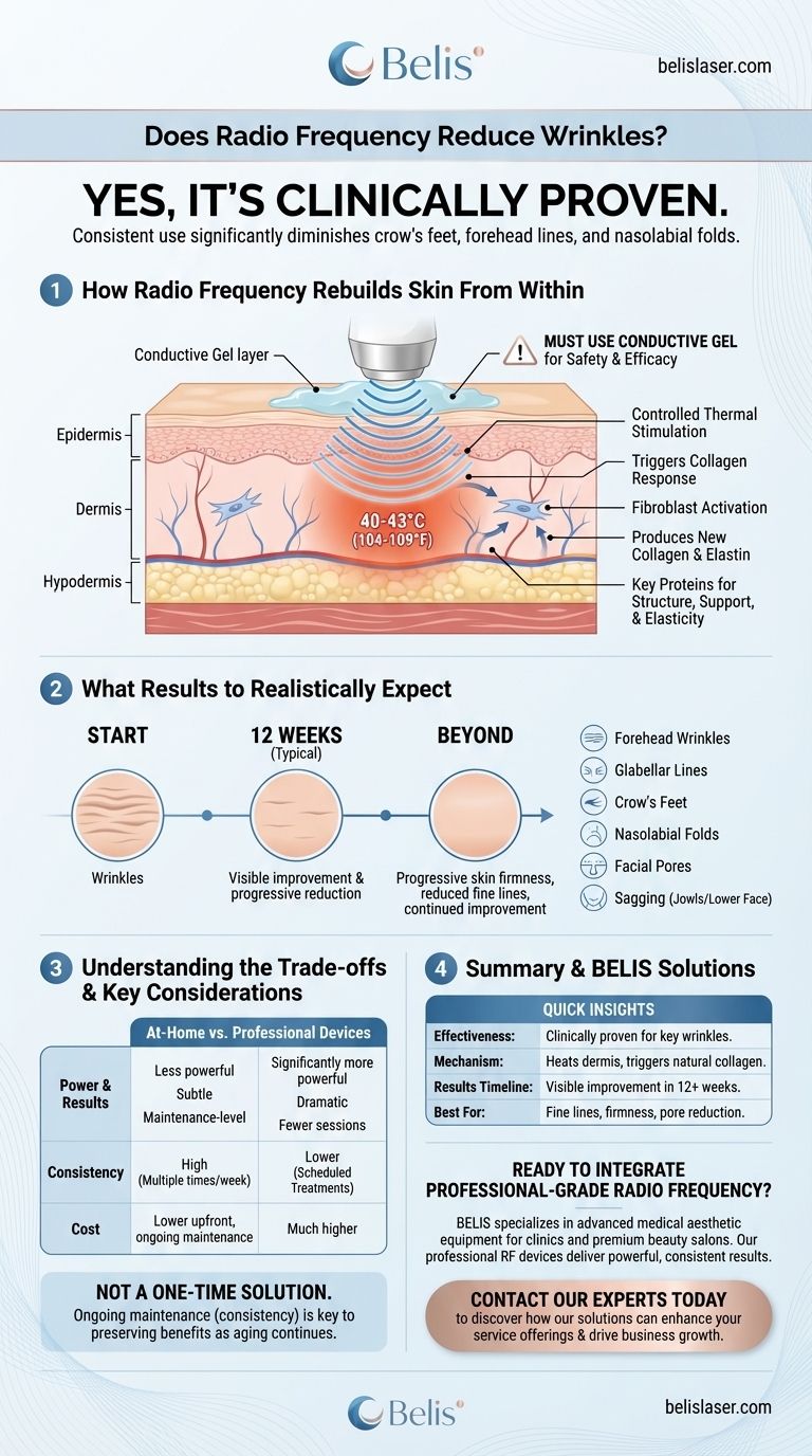 고주파가 주름을 줄여주나요? 임상적으로 입증된 콜라겐 재생을 경험하세요 시각적 가이드