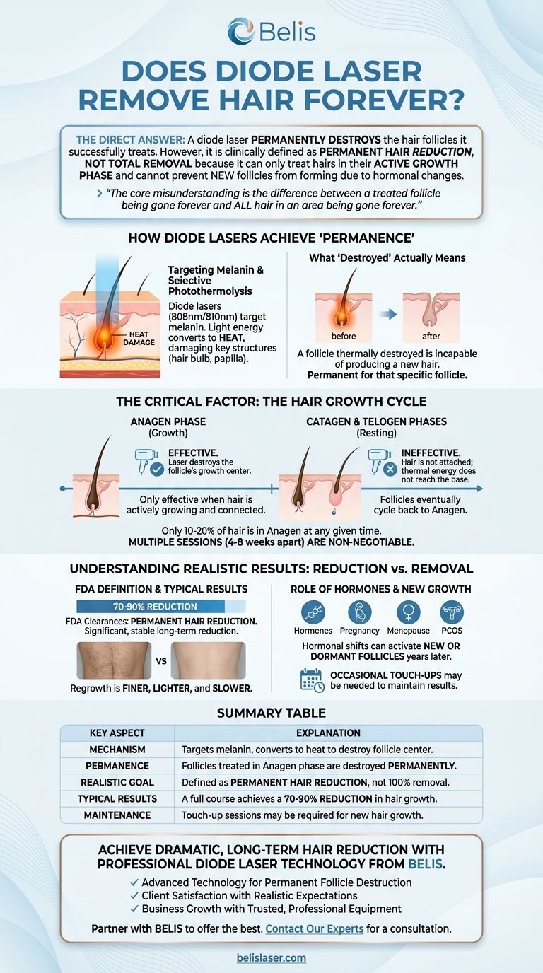 ダイオードレーザーは永久に毛を除去しますか？永久減毛と永久脱毛の違いを理解する ビジュアルガイド