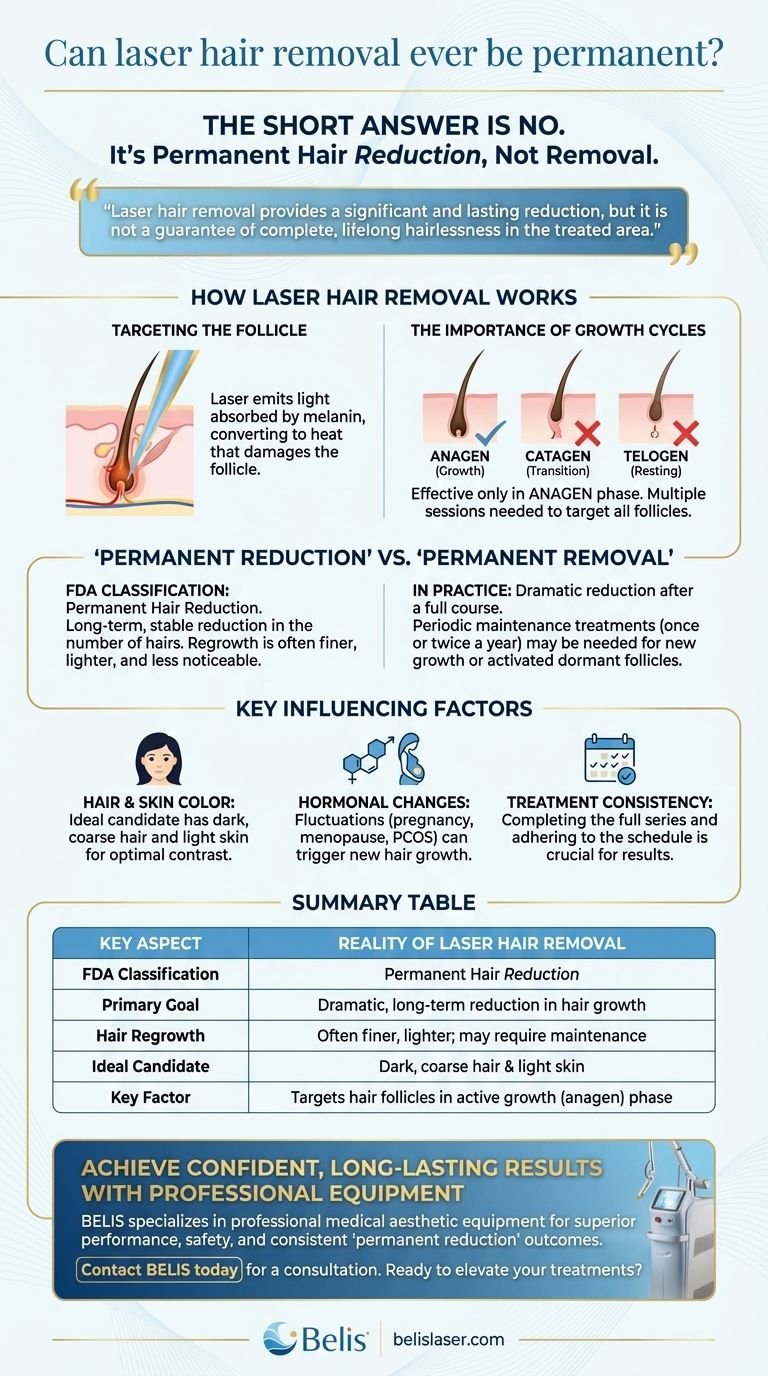 レーザー脱毛は永続的な効果がありますか？永久的な減毛の現実を理解する ビジュアルガイド